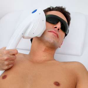 laser treatment for hair removal