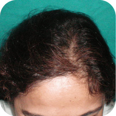 Hair loss treatment clinic